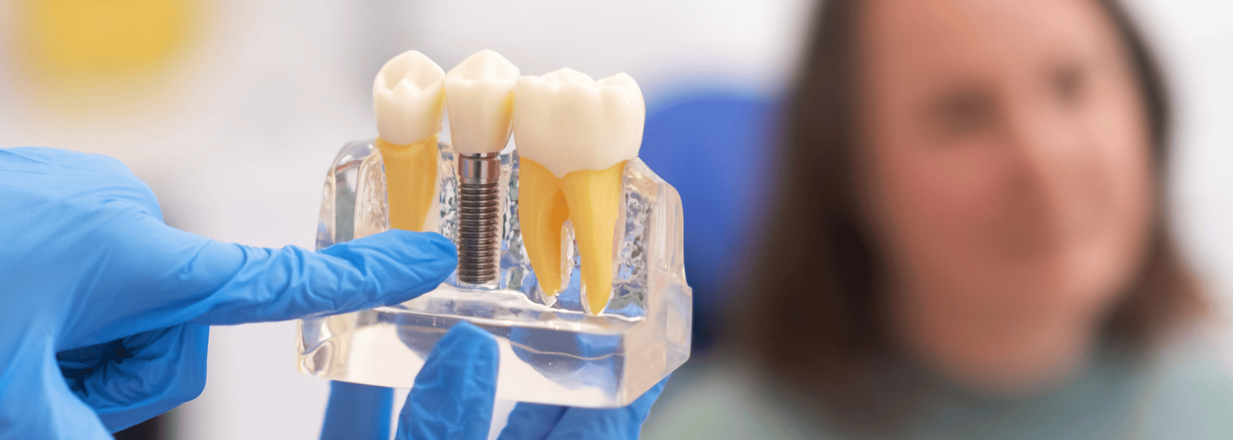 doctor showing patient dental implants